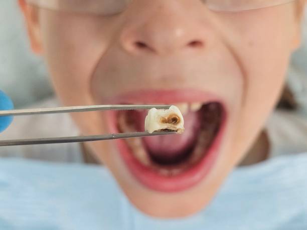 Best Tooth Infection Emergency Dentist  in Murraysville, NC